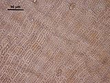 9 - Cellule corticali della porzione filiforme in visione superficiale